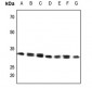 Anti-GRB2 Antibody